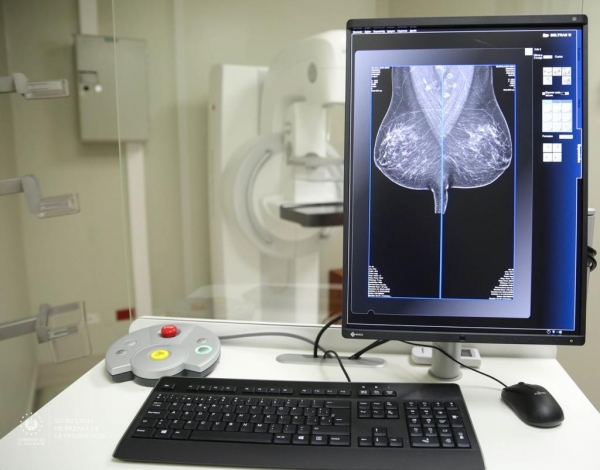 Entregan mamógrafos digitales