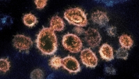 Científicos sugieren que la variante Lambda del coronavirus es &quot;más infecciosa&quot;