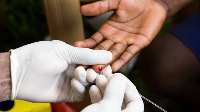 Mujer podría haberse curado del VIH por inmunidad natural