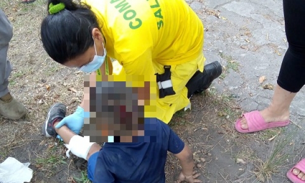 Niño se suelta de la mano de su madre y fue atropellado por motociclista