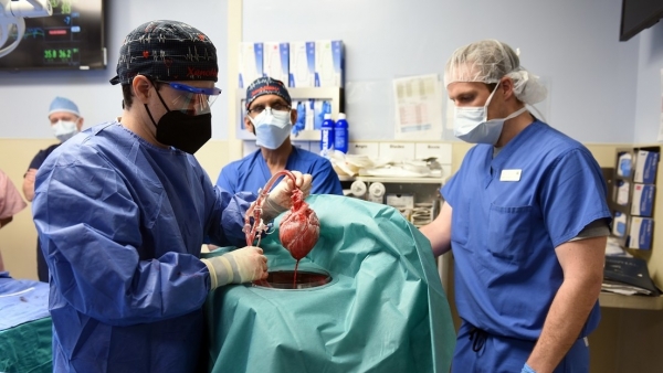 Paciente recibe el corazón de un cerdo
