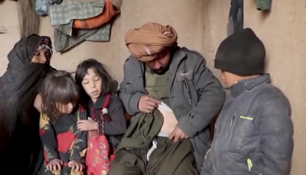 Afganos venden sus órganos para alimentar a su familia